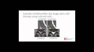 Regenexx Spine Presentation