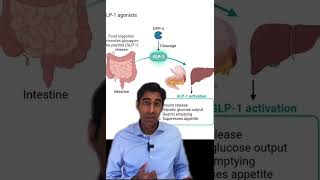 Ozempic and Wegovy Causing Stomach Paralysis? Explained by Endocrinologist