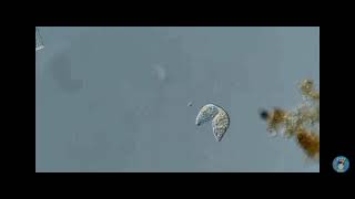 single_celled lacrymaria olor hunts Down Another cell