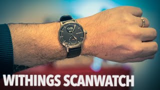 Withings Scanwatch : 2 mois avec la montre la plus avancée au monde