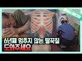 잘 수도 먹을 수도 없게 하는 공포의 딸꾹질, 도와주세요┃Unstopping Hiccups for 6 Years, Threatening His Life