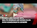 Kondisi Balita 2 Tahun Korban Penyiraman Air Keras Ayah Kandungnya | Kabar Petang Pilihan tvOne