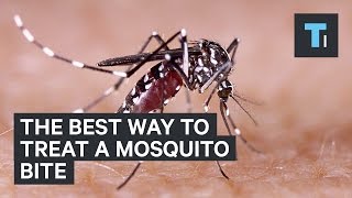 The best way to treat a mosquito bite