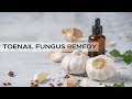 Treat Nail Fungal infection with These DIY Toenail Fungus Home Remedies I Nail Infection Home Remedy