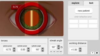 Retinoscopy practice online #eye