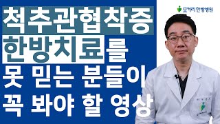 척추관협착증 한방치료 효과를 못 믿으신다구요? 이 영상을 보시면 믿게 됩니다.