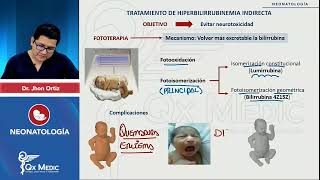 NEONATOLOGÍA | Ictericia neonatal: Bi-tratamiento