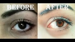 Homemade Eye Brightening Serum / Dark Circle Removing Serum