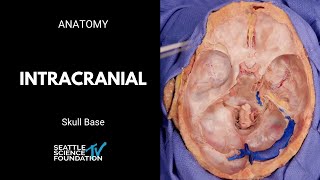 Skull base: intracranial