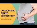 Laparoscopic Sleeve Gastrectomy |Weight Reduction Surgery |Digestive Surgery Clinic