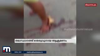 വിഴിഞ്ഞത്ത് തെരുവുനായ ആക്രമണം | Mathrubhumi News