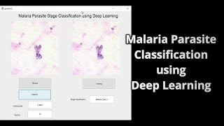 Malaria Parasite Classification using Deep Learning