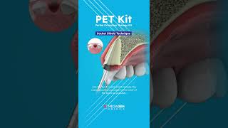 👉 Discover the Socket Shield Technique with our PET Kit! 💡