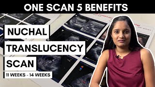 5 Benefits of Nuchal Translucency Scan (NT scan) | Pregnancy Scan (11-14 weeks)