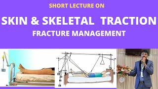 SKIN \u0026 SKELETAL TRACTION IN FRACTURE MANAGEMENT