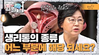 산부인과 전문의의 생리통의 원인과 치료법, 항염증소염제 치료요법과 약물 복용 방법을 알아보자│클래스e │뇌벨업