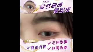 一次定型自然無痕雙眼皮/不開刀/7日閉眼無痕