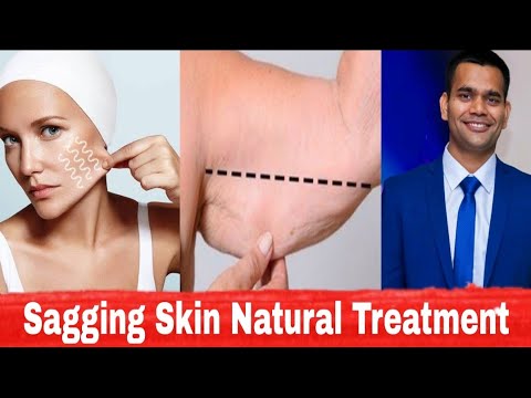 Get Rid Of Loose Flabby Skin Naturally | Dr. Vivek Joshi - YouTube