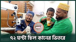 শিশুটির কান থেকে যেভাবে বের করা হলো জীবন্ত পোকা | Dr. Bashudeb Kumar Saha