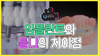 임플란트식립 대해 알아보자! ㅣ 틀니와 임플란트의 차이점은?!  (The difference between dentures and implants)