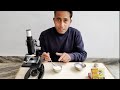 माइक्रोस्कोप से दही को देख लेंगे तो कभी नहीं खाएंगे curd in microscope dahi in microscope