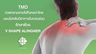 TMD ปวดกรามลามไปถึงคอบ่าไหล นอนไม่หลับ มีอาการไมเกรนร่วม รักษาด้วย V Shape Alingner