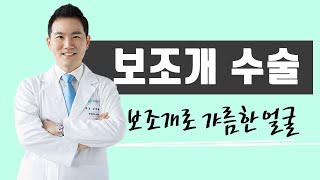 보조개는 어떻게 만들까?? 과정과 효과 하나씩 알려드립니다. #보조개