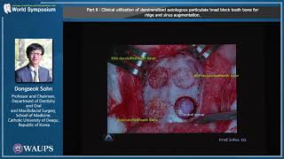 [World Symposium] Part 2. Lecture of Prof. Dong-Seok Sohn