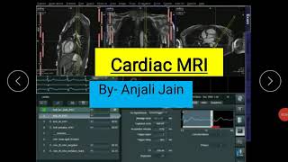 Cardiac MRI in detail