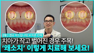 [대진다] 치아가 작은 분들은 이렇게 치료하세요❗️│왜소치, 덧니, 중년교정, 라미네이트, 인비절라인│#마흔 번째