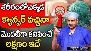 ఒంట్లో కాన్సర్ కణాలు ఉంటె కనిపించే సూచనలు || Dr.Mohan Vamsi About Cancer || Sumantv health Care