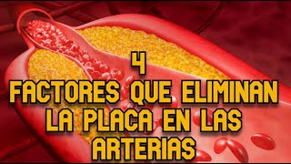 4 Factores que Eliminan la Placa en las Arterias