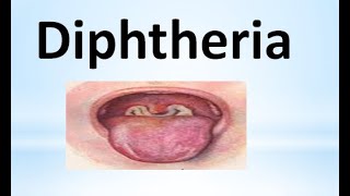Diphtheria Corynebacterium
