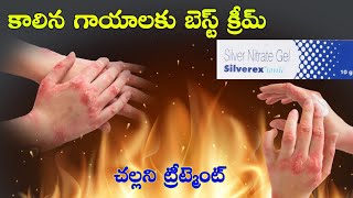 Silverex ionic gel uses in telugu | best creams for burns | telugu | కాలిన గాయాలకు బెస్ట్ క్రీమ్