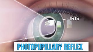 What is Pupillary Light Reflex or PLR?