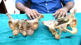 Differences between male and female bony pelvis