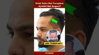 Elvish Yadav Hair Transplant Surgury Video😯 | @ElvishYadavVlogs Hair Transplant #trending #shorts