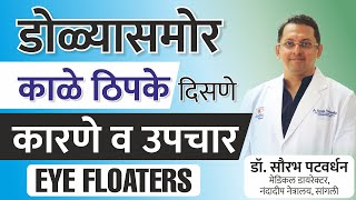 डोळ्यासमोर काळे ठिपके दिसणे कारणे व उपचार Marathi | Eye Floaters Risks \u0026 Treatments