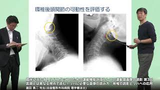 臨床に活かす！リハスタッフのための運動機能評価としての運動器画像の読影 (3)医師とは異なる視点で読む！リハに必要な画像の読み方：脊椎の読影とリハへの応用(瀧田 勇二 先生)