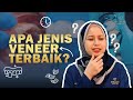 Veneer Gigi Terbaik 2024: Mana yang Paling Sesuai untuk Anda?