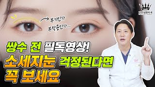 쌍수 망한거 아니야..?😣 쌍꺼풀수술 후 소세지눈 걱정된다면 필수 시청💥