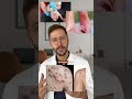 Keloide: Wenn Narben wachsen | DERMAFY #shorts