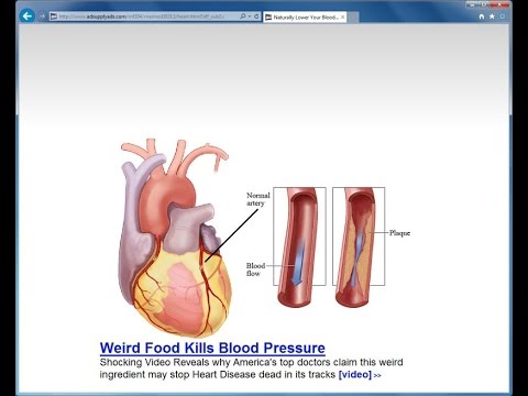 how to remove adsupplyads.com pop up ads Virus Removal Guide from chrome,firefox,explorer how to remove adsupplyads.com pop up ads Virus Removal Guide from chrome,firefox,explorer