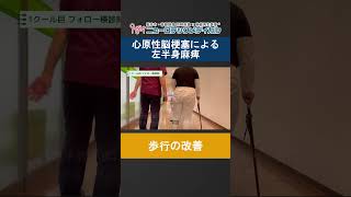 【本編は関連動画から】心原性脳梗塞で左半身麻痺になられた患者様の歩行の改善の様子【再生医療＋リハビリ】 #心原性脳梗塞 #再生医療 #左半身麻痺 #脳梗塞