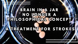 Brain in a jar: Medical uses for our lab grown brains