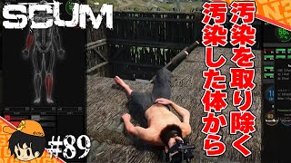 【scumシーズン２】汚染された体を綺麗にするのは一筋縄ではいかないみたいです【スカム攻略実況】 #89