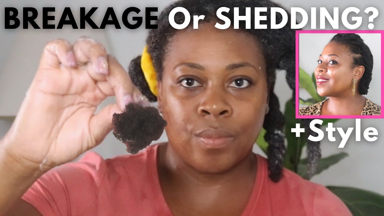 Hair Shedding, Breakage, Or Hair Loss? What's The Difference? - YouTube