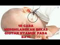 Cara Mudah Menghilangkan Bekas Gigitan Nyamuk Pada Bayi