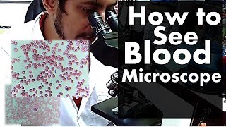 How to watch blood under microscope