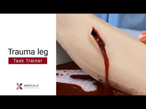 What is considered a deep laceration?